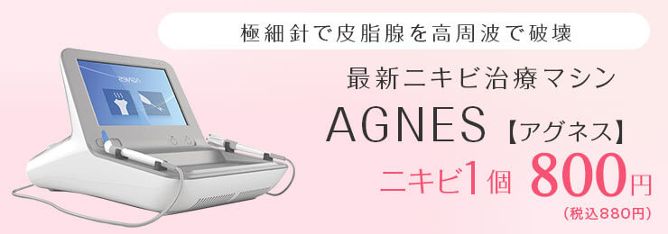 最新ニキビ治療マシン AGNES【アグネス】 ニキビ1個 800円