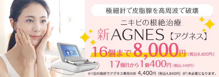 再発しないニキビ治療 新AGNES【アグネス】16個まで8,000円 17個目から1個400円