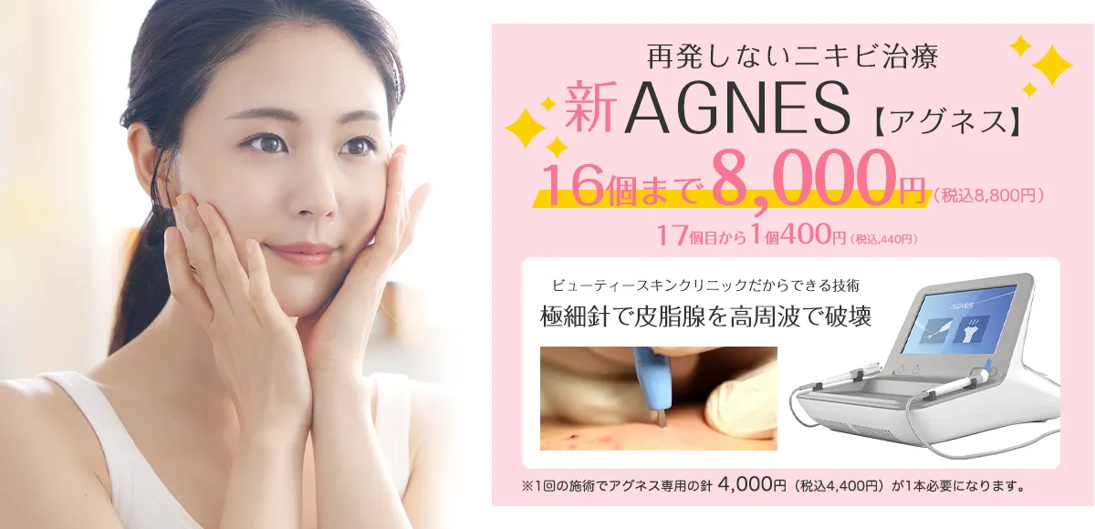 再発しないニキビ治療 新AGNES【アグネス】16個まで8,000円 17個目から1個400円