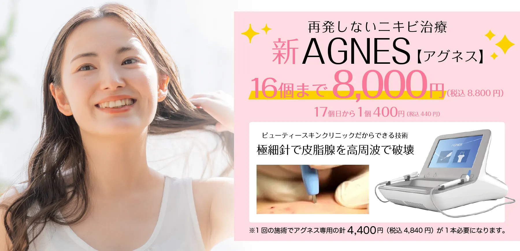 再発しないニキビ治療 新AGNES【アグネス】16個まで8,000円 17個目から1個400円