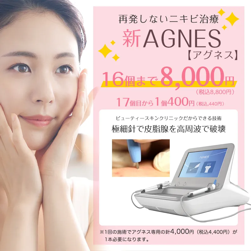 安いAGNES【アグネス】 | 新宿/渋谷/池袋のニキビ治療専門