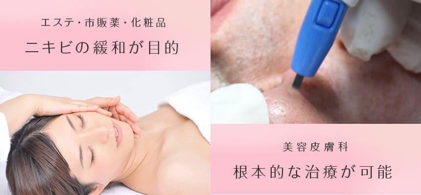 エステ・市販薬・化粧品 ニキビの緩和が目的 美容皮膚科 根本的な治療が可能