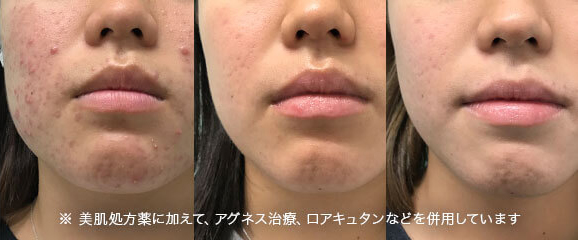 シミ消し処方セット 内容一覧