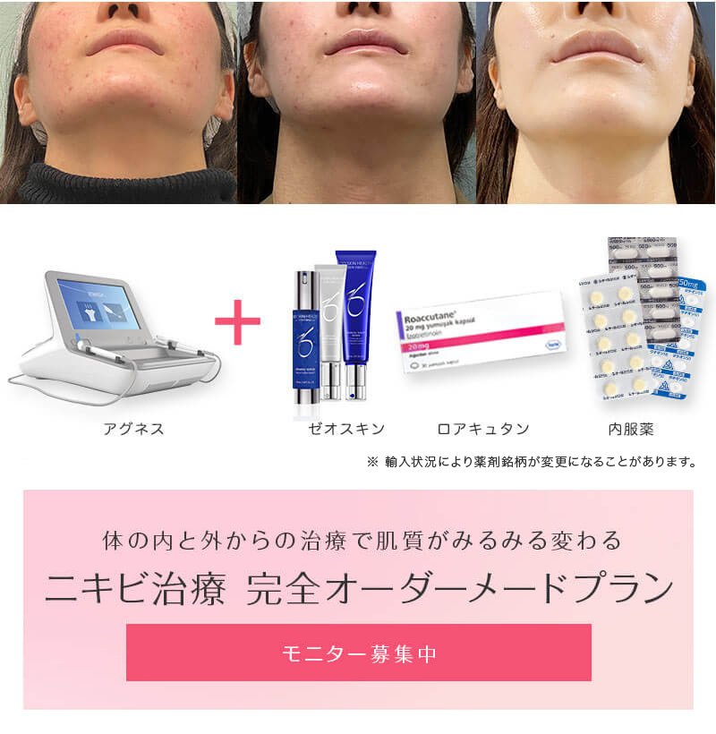 beautyskinclinic.jp/nikibi/wp-content/themes/nikib...