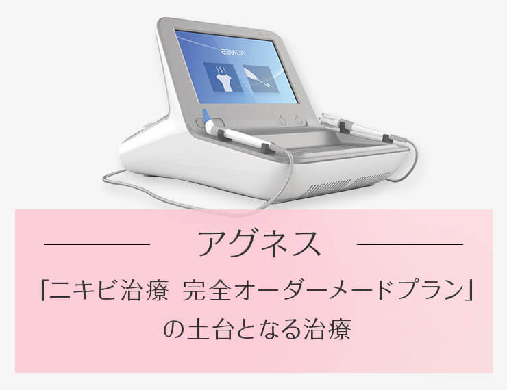 アグネス