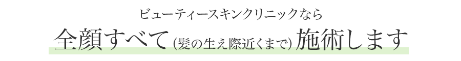 ビューティースキンクリニックなら全顔すべて施術します