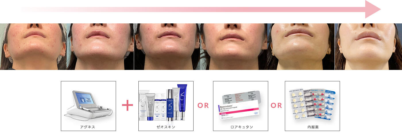 皮膚科医師による完全オーダーメードプラン