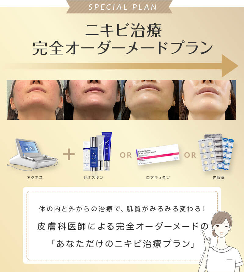皮膚科医師による完全オーダーメードプラン