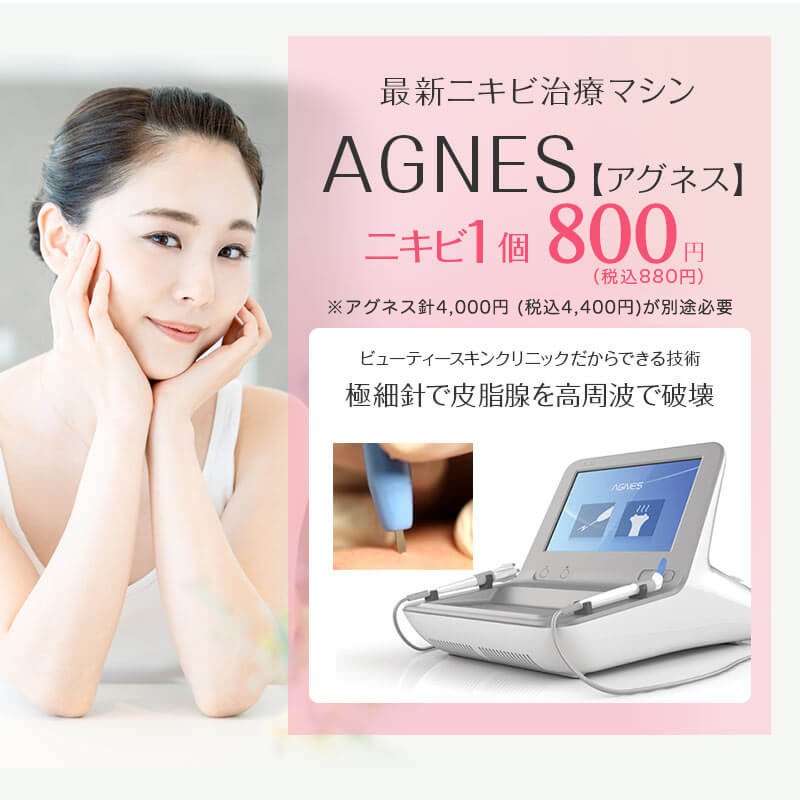 最新ニキビ治療マシン AGNES【アグネス】ニキビ1個 800円