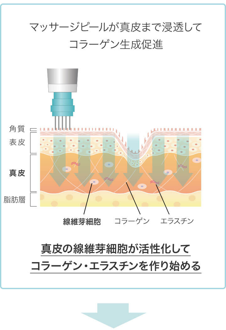 マッサージピール(PRX-T33)の施術イラスト