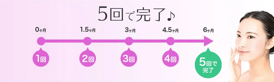 5回で完了