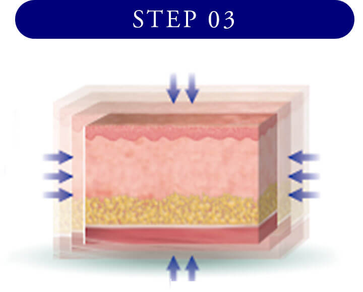 STEP3 損傷を治癒する過程でコラーゲン組織を再構築させて筋膜、脂肪組織をタイトニングします。