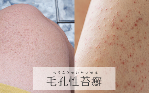  1. 不均一な重量配分